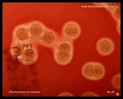 aureus beta bemolysis